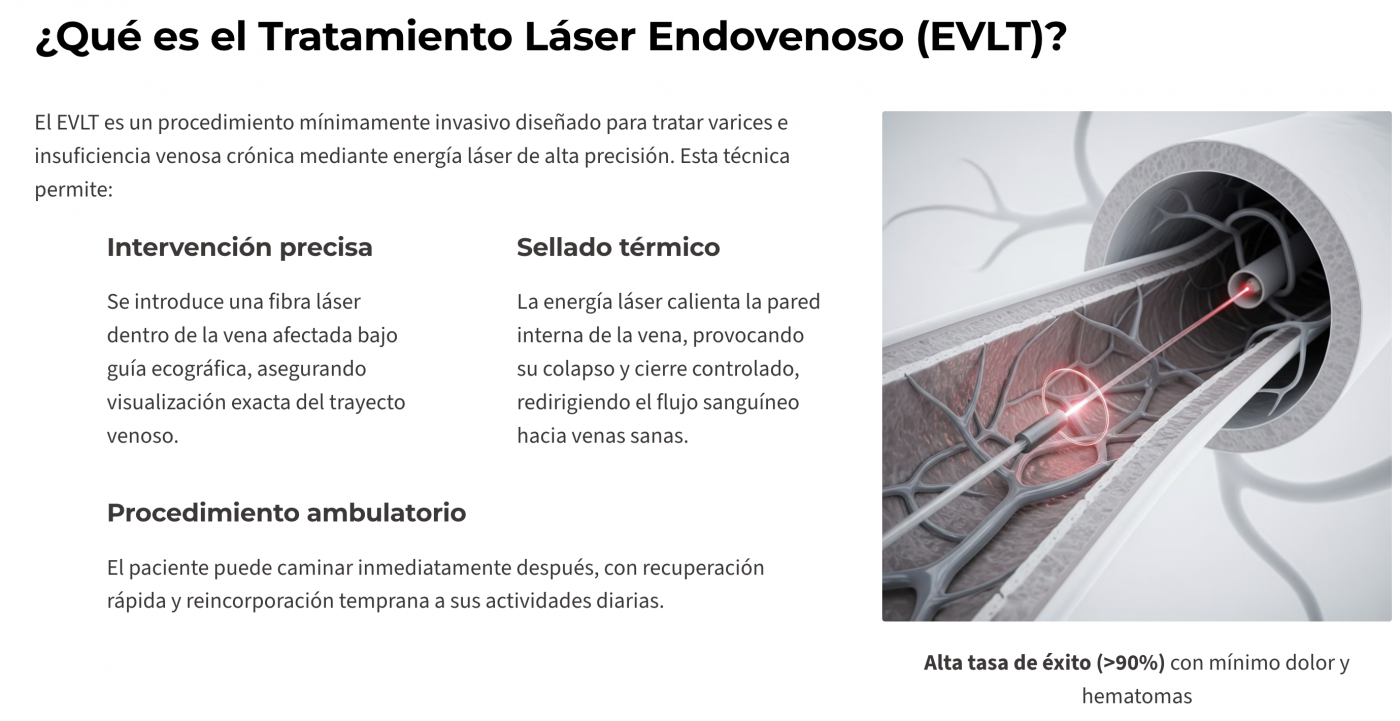 laser endovenoso